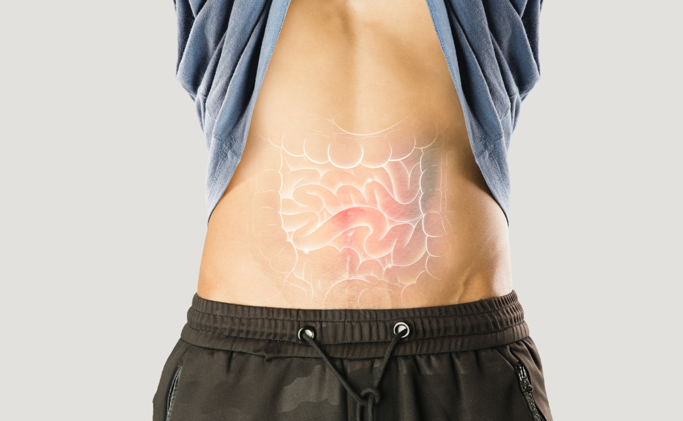 Malattia di Crohn