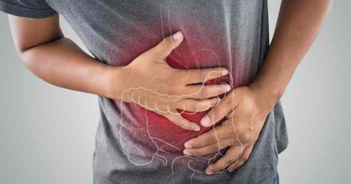 colon-irritabile-2